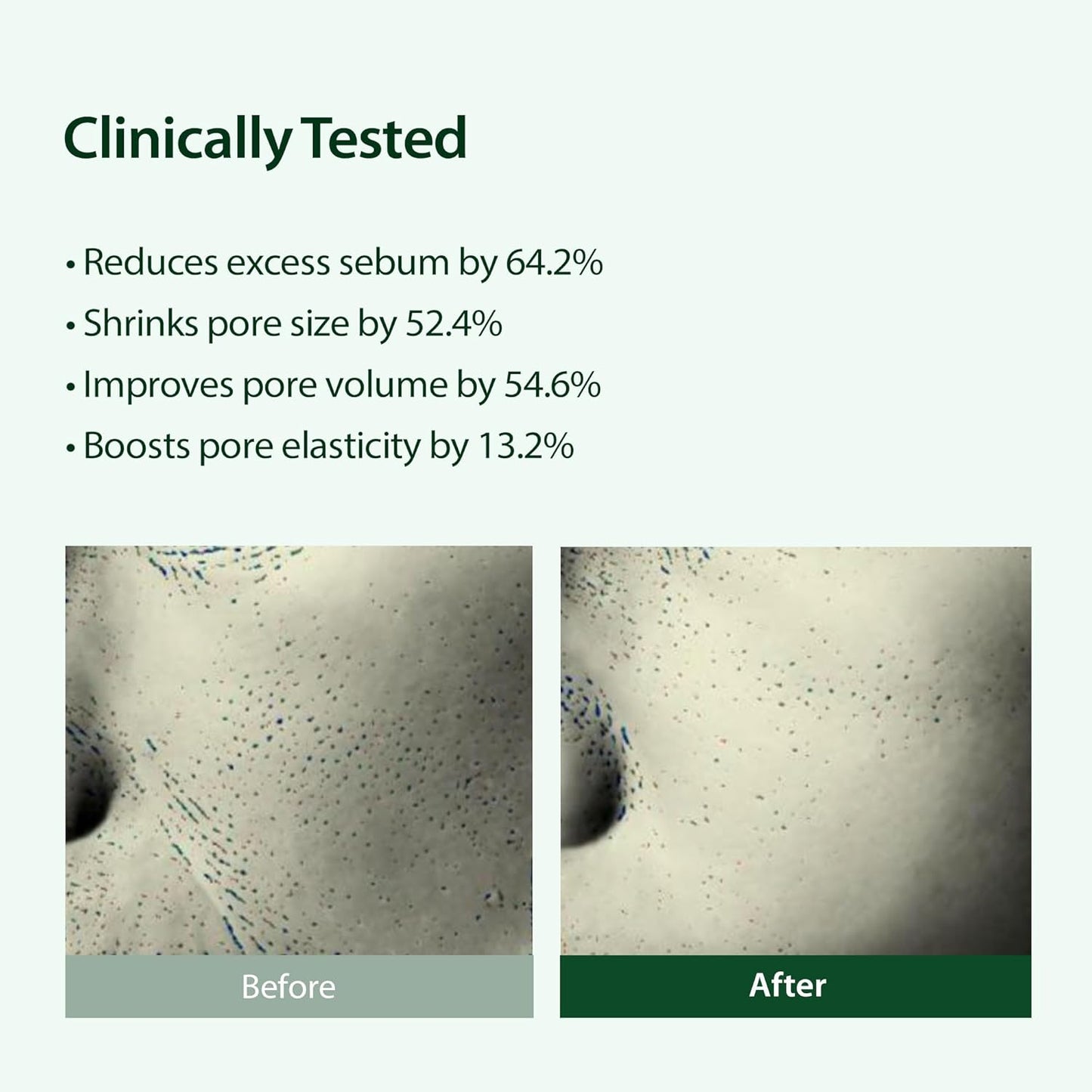BLITHE Targeted Pore Serum with 22% Niacinamide for Oil Control, Pore Minimizer for Face, Korean Skin Care,1 fl oz