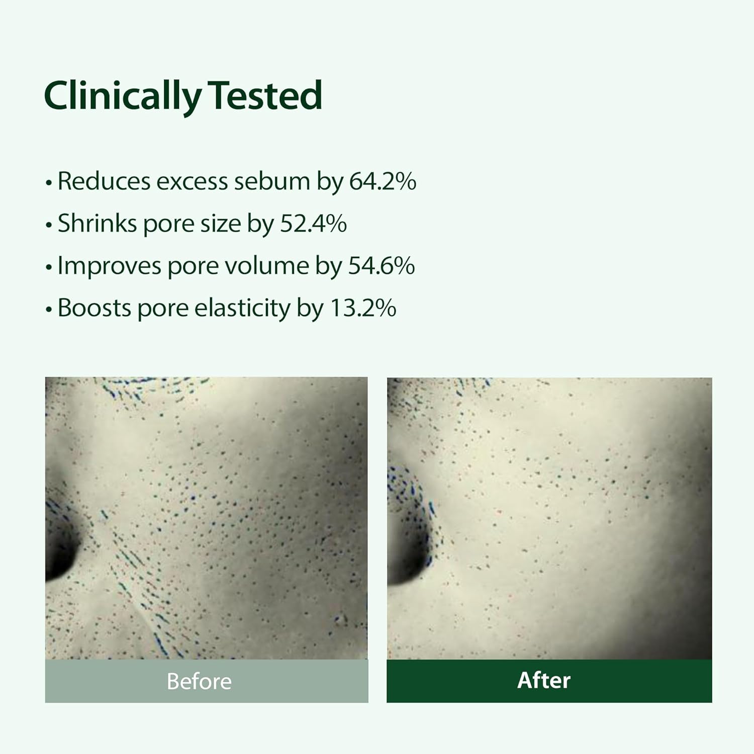 BLITHE Targeted Pore Serum with 22% Niacinamide for Oil Control, Pore Minimizer for Face, Korean Skin Care,1 fl oz