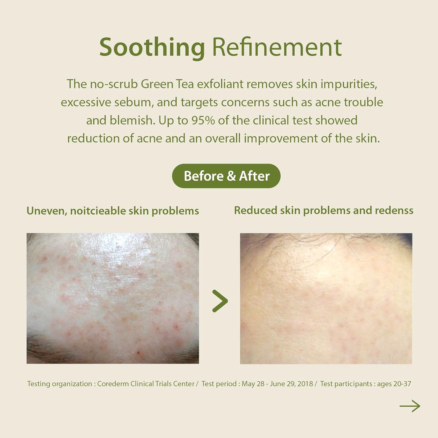 BLITHE Exfoliating Face Wash with AHA Yellow & Green Tea Mask - Lactic Acid Facial Wash Exfoliant with Green Tea for Pore Care, Yellow Citrus Honey Mask for Brightening